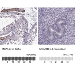 MGAT4D Antibody, Novus Biologicals:Antibodies:Primary Antibodies